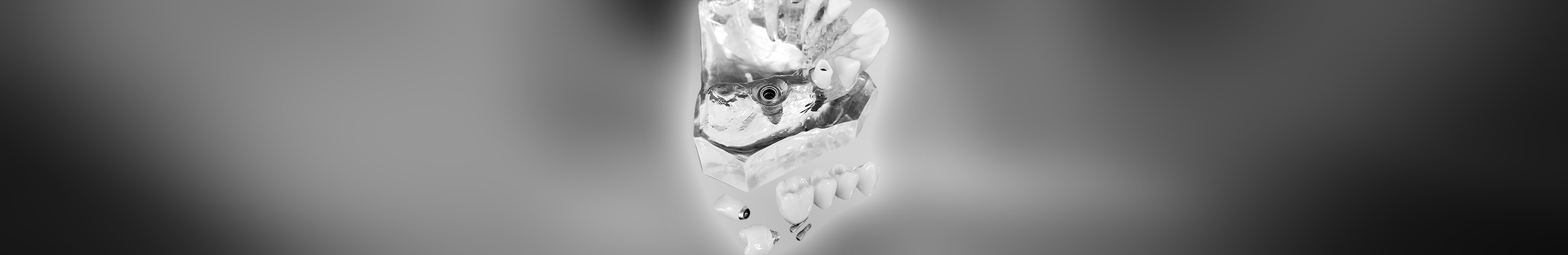 Implantate